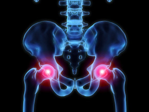 hip pain prolotherapy